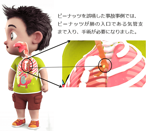 消費者庁 節分の豆等は5歳以下の子供に絶対食べさせないで 大変危険 よどきかく